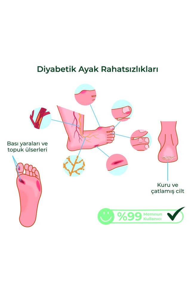 Ayak Bakım Kremi – Hassas Ciltlere Özel (%10 Üre, Shea Butter, Beeswax)