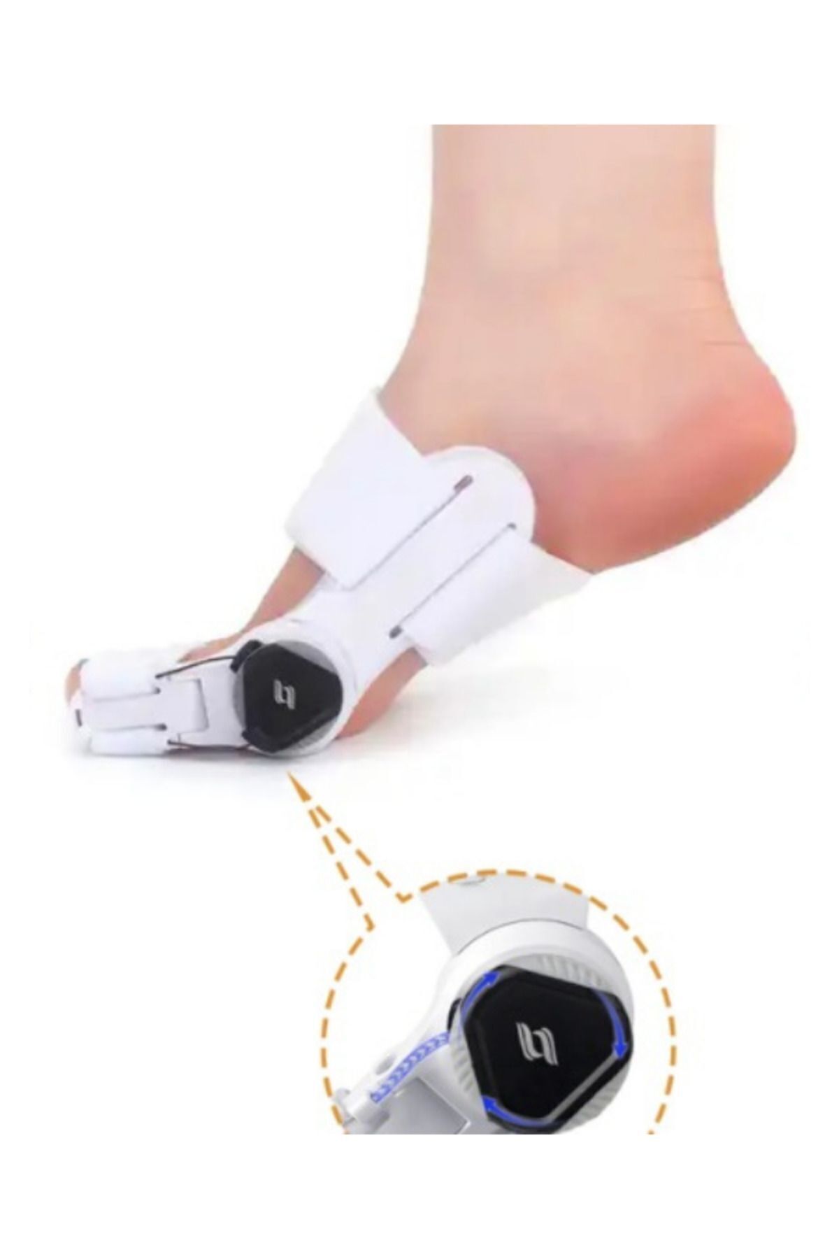 Ayarlı Baş Parmak Kemik Düzeltici - Halluks Valgus - Baş Parmak Eğriliği Düzeltme