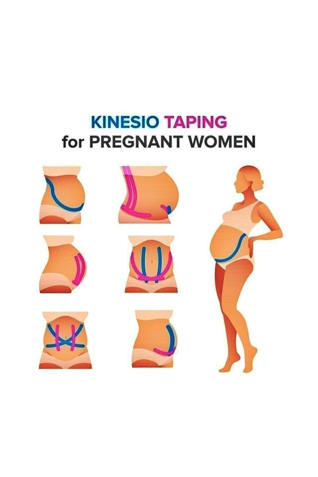 Ağrı Bandı Kinesiotape Bantlama Sporcu Bandı Sakatlık Bandı Kinesio Bant Kas Bandı Bilek Bant 1 Adet